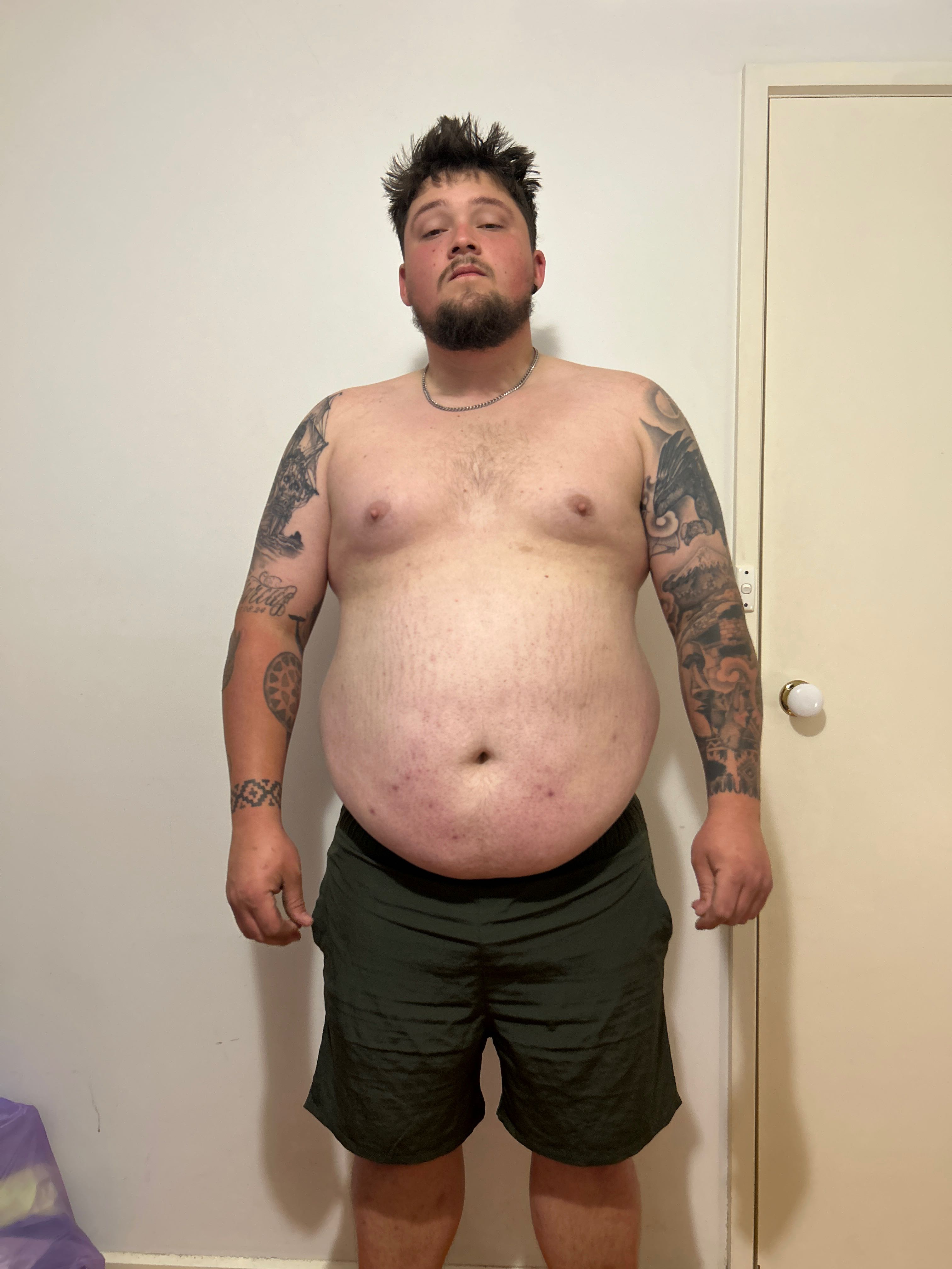 Ethan - before